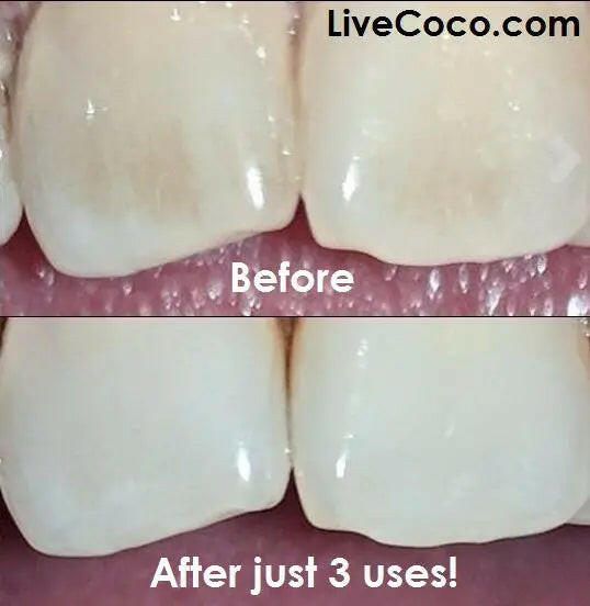 Teeth Cleaning Powder (Vitamins & Aloe Vera Infused).